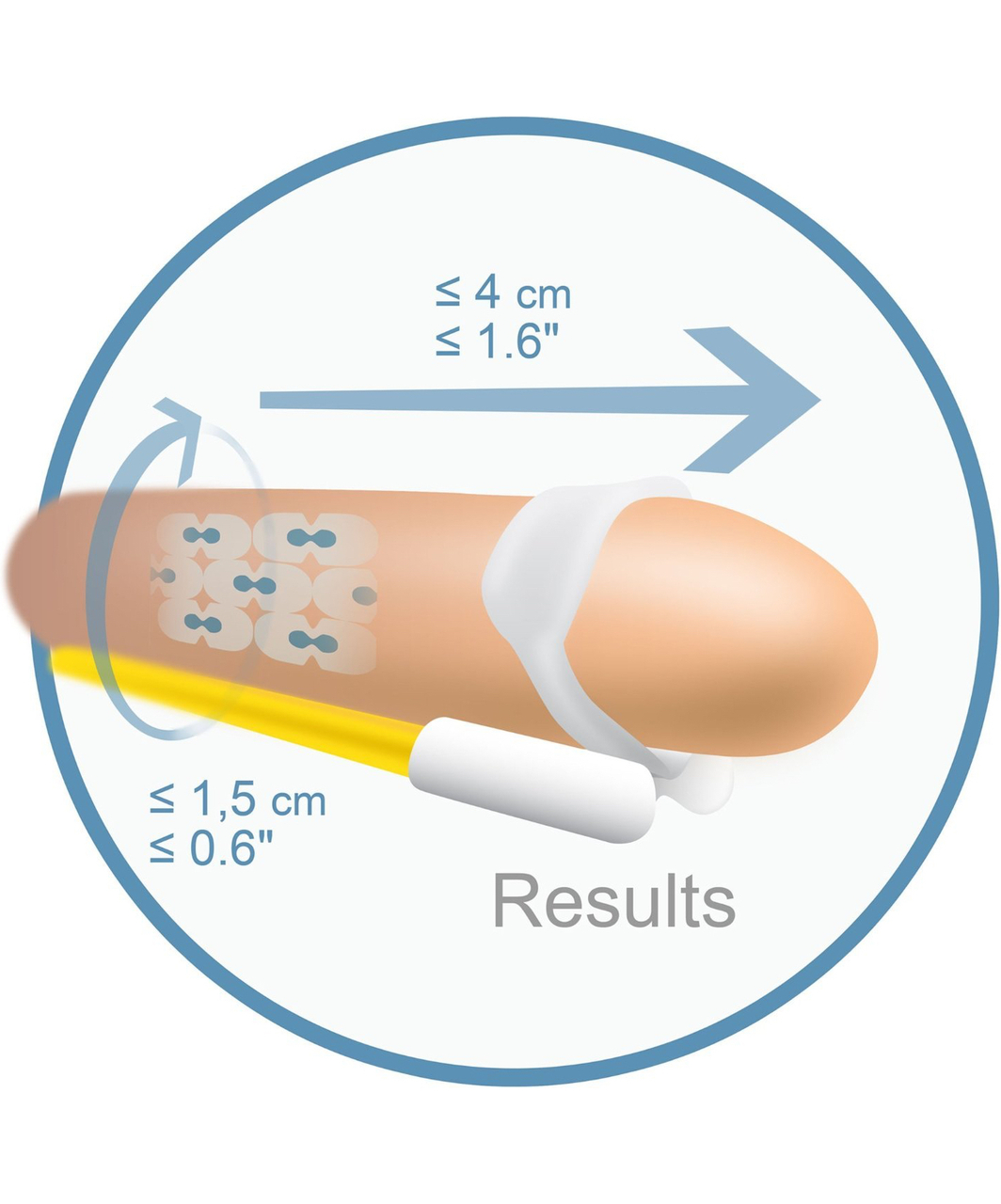 Andromedical Andropenis Pro varpos ilgintuvas